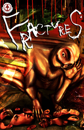 Fractures